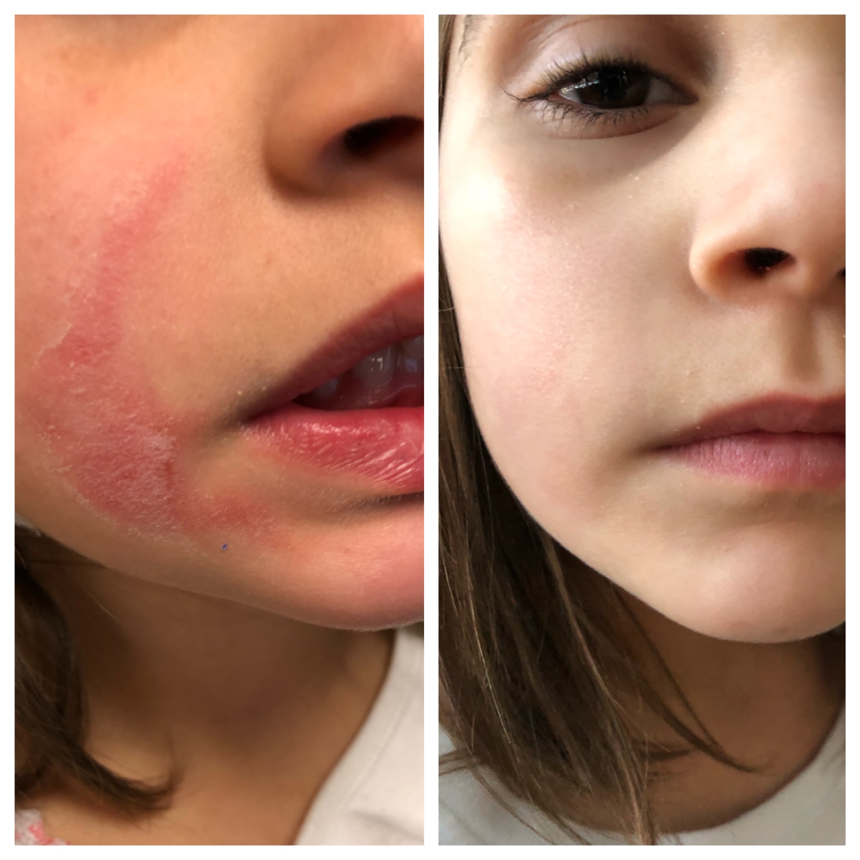 child-before-after.jpg child-before-after.jpg